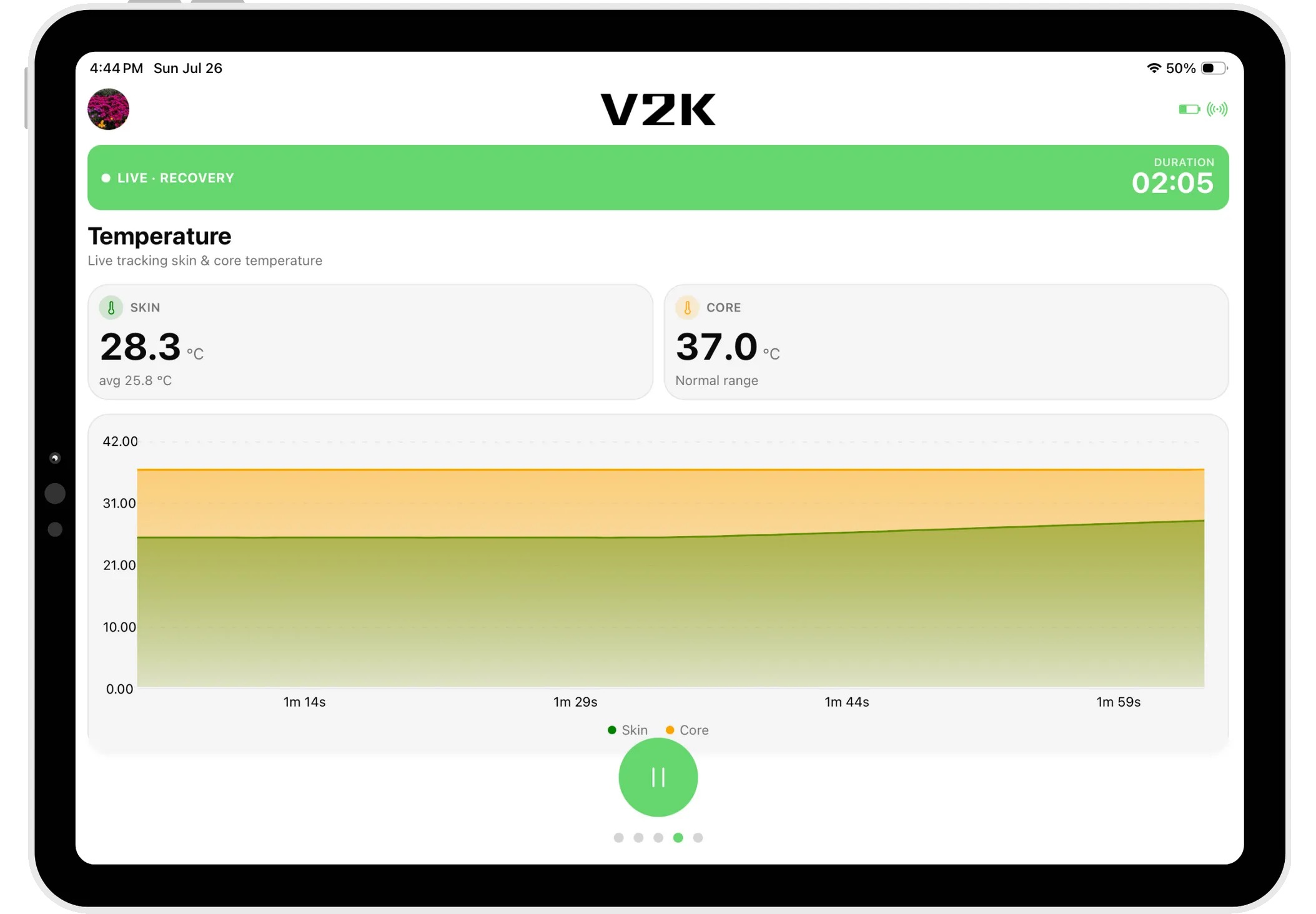 Live skin temperature during a session